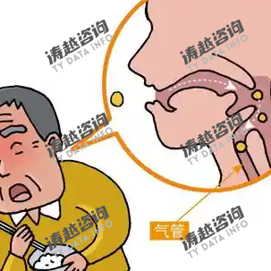 吞咽困难介护食
