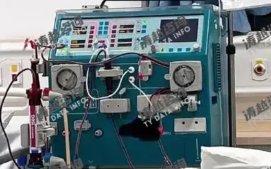 血液透析机